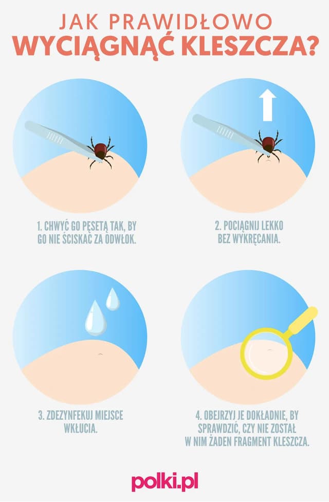 Co zrobić po wyciągnięciu kleszcza? Kluczowe kroki, aby uniknąć problemów Co zrobić po wyciągnięciu kleszcza? Kluczowe kroki, aby uniknąć problemów